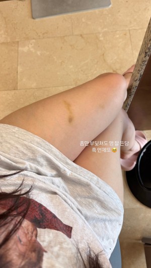 xxapplee Nude Leaks OnlyFans Photos #69